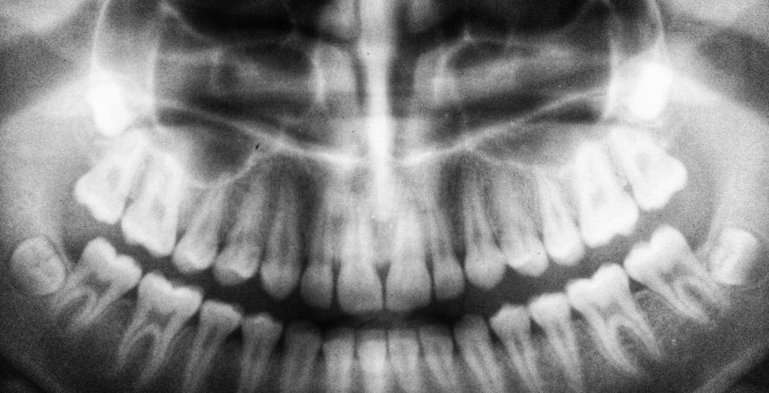 cirurgia ortognática